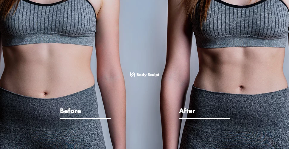 What is Body Sculpting and How Does it Work? Everything You Need to Know -  MYVY